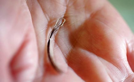 Hormonas, genes y estrés pueden arrancar cabelleras