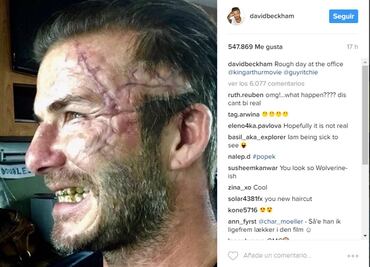 Beckham impacta Instagram con cicatriz