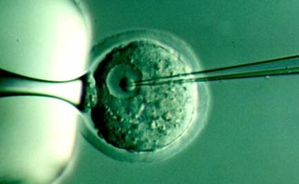 Identifican gen vinculado con metástasis por cáncer de próstata