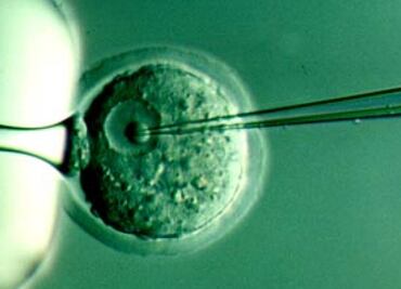 Identifican gen vinculado con metástasis por cáncer de próstata