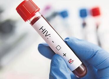 Descubren que prometedor fármaco para prevenir el VIH tiene algunas desventajas