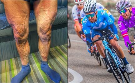 ¡Impresionante! Ciclista muestra los estragos en sus piernas por la Vuelta a España