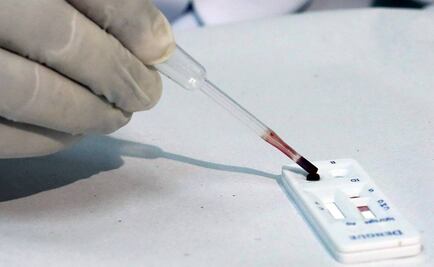 EU confirma 3 casos del virus Zika en Florida