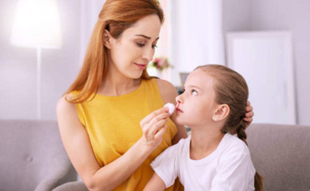 Esta es la razón por la que los niños sufren de sangrado en la nariz sin razón. Foto: Pixabay