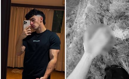 ¿Quién es Gero Arias?; el influencer que perdió dos dedos tras caer a más de 10 metros de altura