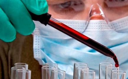 Investigaciones científicas que buscan eliminar el sida