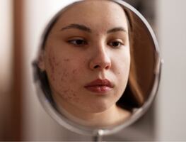 ¿Qué es la “hierba del soldado”?; estos son sus beneficios para la salud