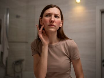 ¿Cómo cuidar la piel con rosácea?