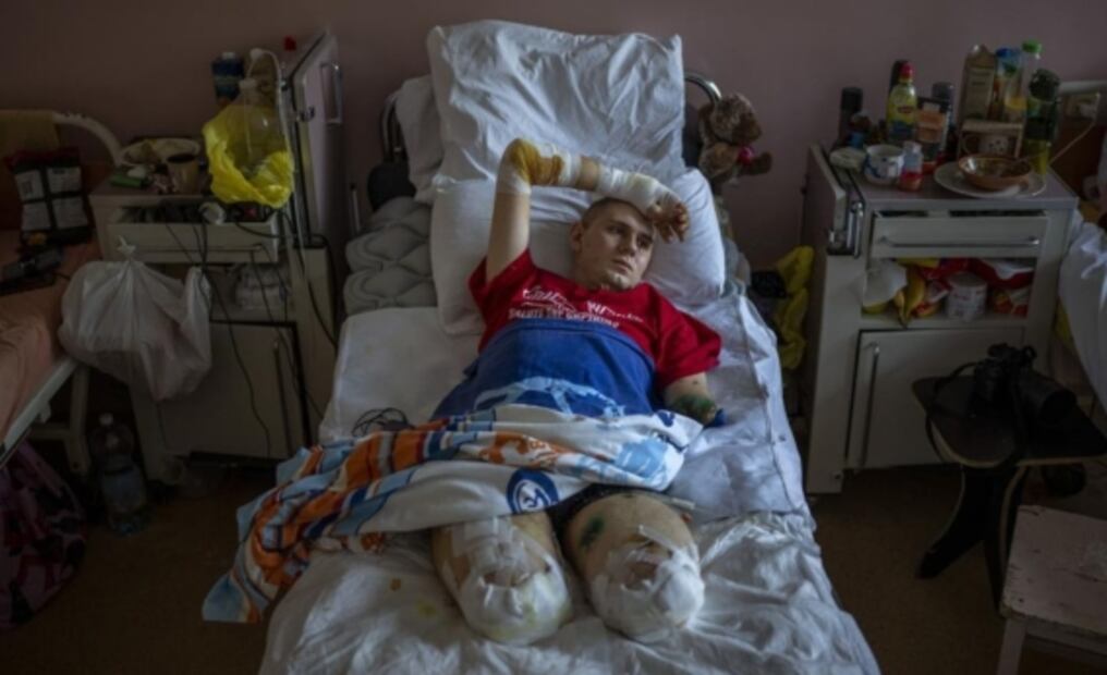 Amputados: el costo humano de la guerra Rusia VS Ucrania 