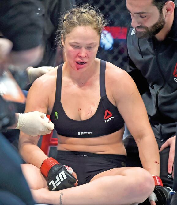 Rousey agradeció en Instagram la preocupación por su estado de salud (ANDY BROWNBILL. AP)