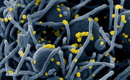 Covid-19: El papel de los anticuerpos IgA para neutralizar el coronavirus