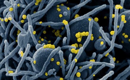 Covid-19: El papel de los anticuerpos IgA para neutralizar el coronavirus