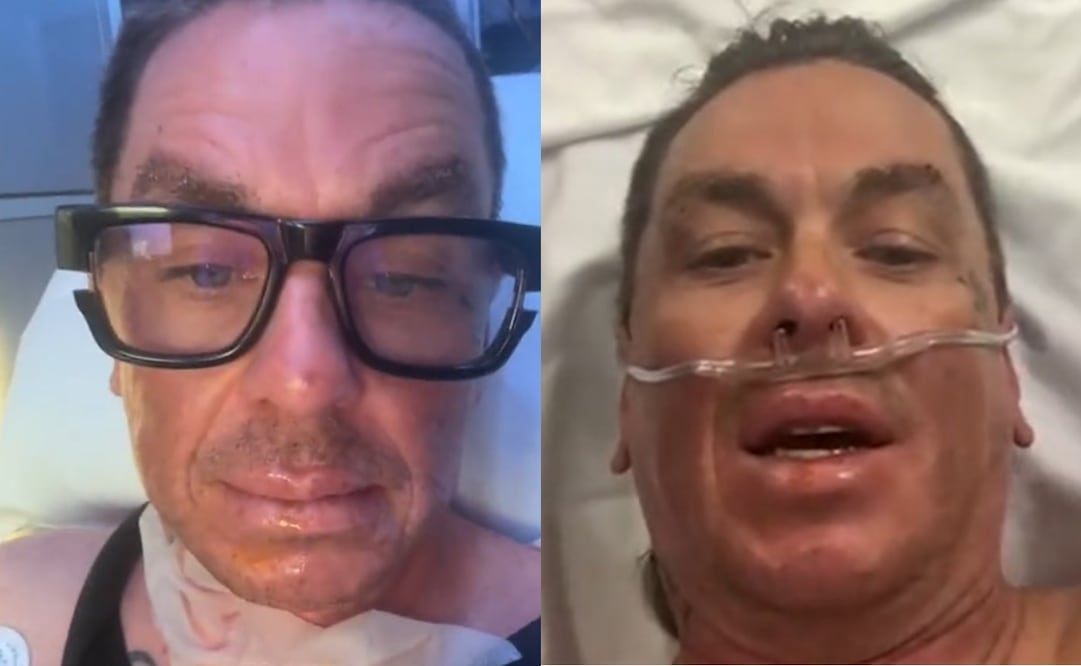 Sid Wilson, compartió el desafortunado accidente en redes sociales. Captura vía Instagram.