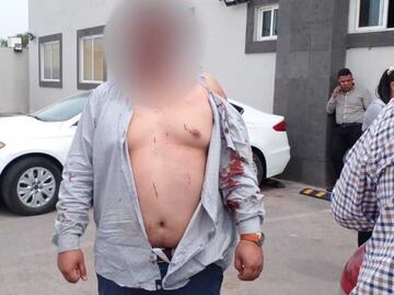 Dan golpiza a policías de investigación al confundirlos con criminales en Edomex