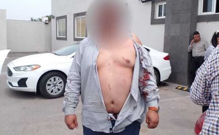 Dan golpiza a policías de investigación al confundirlos con criminales en Edomex