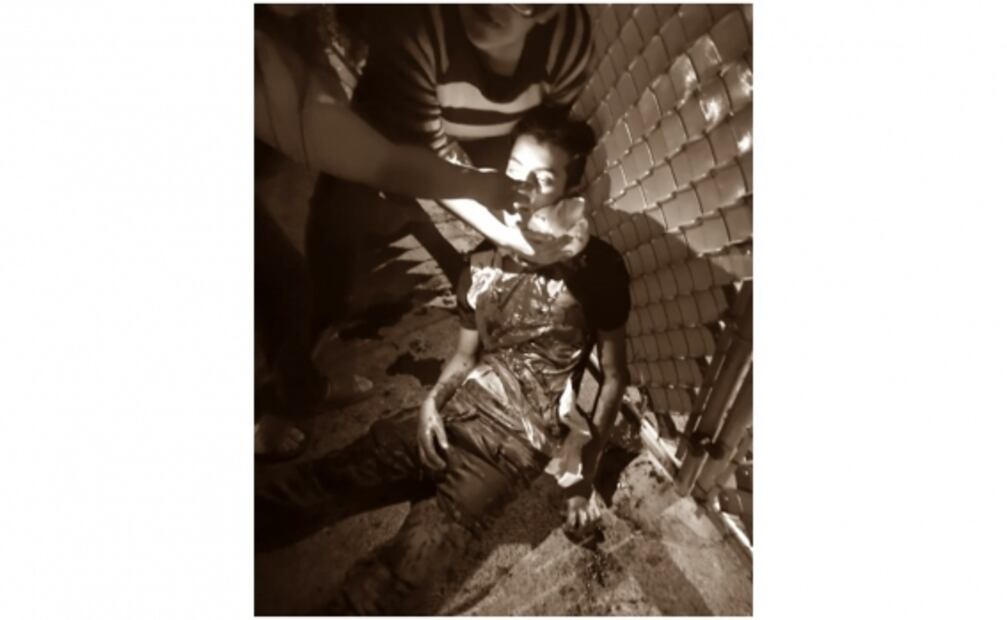 Joven muere apuñalado por riña grupal durante fiesta en Álvaro Obregón