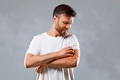 Vacuna basada en ácaros combate la dermatitis con eficacia 