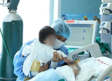 Siameses unidos por el vientre son operados con éxito en Perú