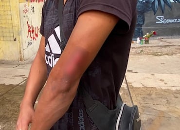 "Fue una tragedia, había mucha gente quemada”; Eduardo asegura que un milagro lo salvó de morir en explosión en Iztapalapa