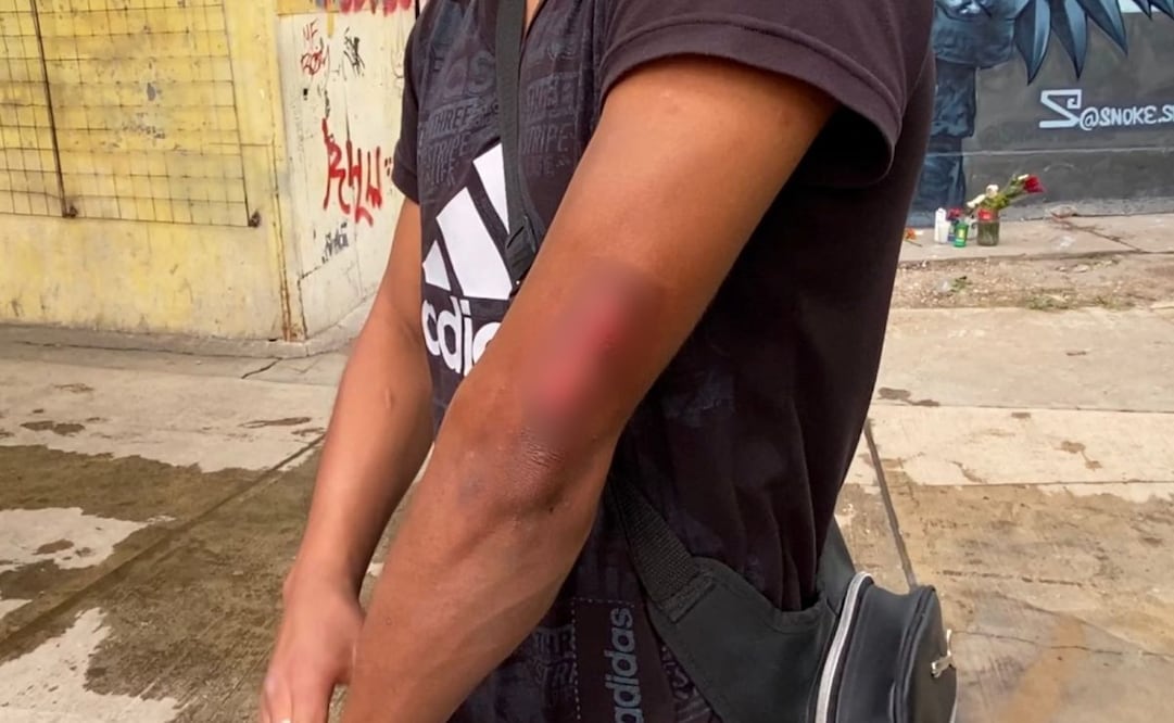 Eduardo asegura que un milagro lo salvó de morir en explosión de una pipa de gas en Iztapalapa . Foto: Emilio Fernández