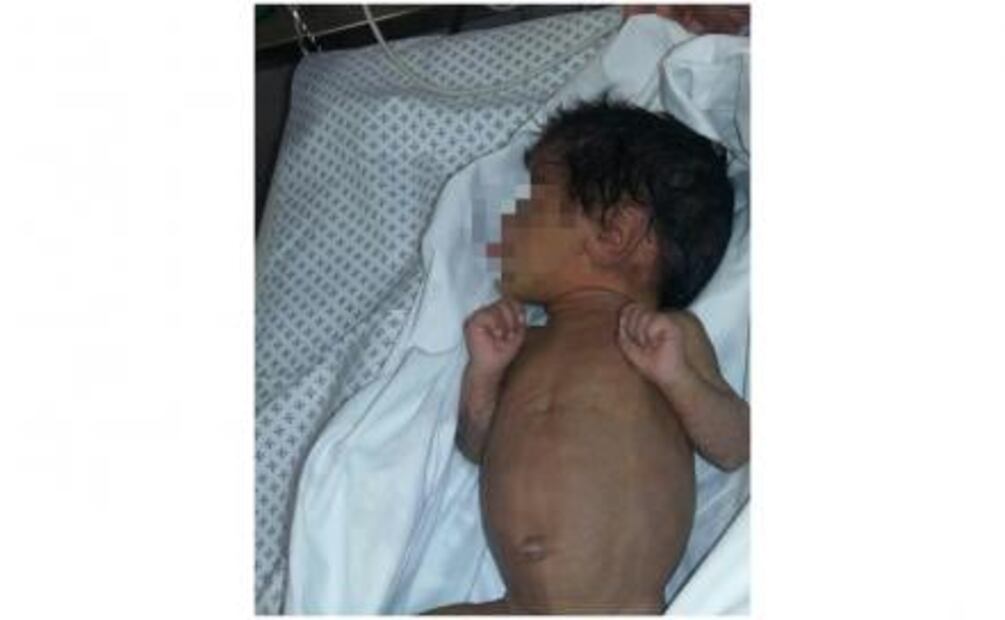 Perro salva a bebé abandonado en una bolsa de basura