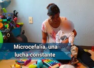 Les dijeron que Edson nacería muerto; lleva 2 años luchando con la microcefalia