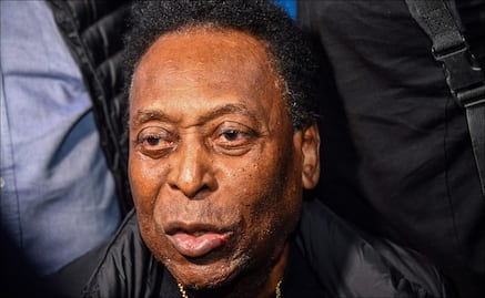 Pelé cumple un mes internado en el hospital