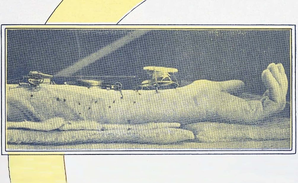 Pulgas comiendo del brazo de Othon Ruhl. Según comentó a EL UNIVERSAL ILUSTRADO, “yo las mantenía a costa de mi sangre y las pulgas principiaron a quererme. Fui por el mundo recogiendo pulgas y haciéndolas trabajar”. Foto: Hemeroteca EL UNIVERSAL.