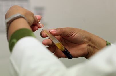 Con muestras de sangre, descubren por qué hay pacientes de cáncer resistentes a la radioterapia