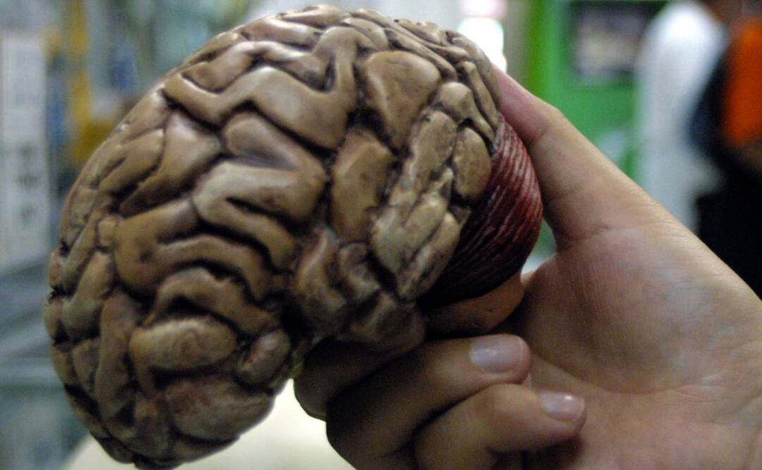 Un estudio señala la parte del hipotálamo al que compuestos químicos farmacéuticos que generan apetito deben dirigirse. FOTO: Archivo.