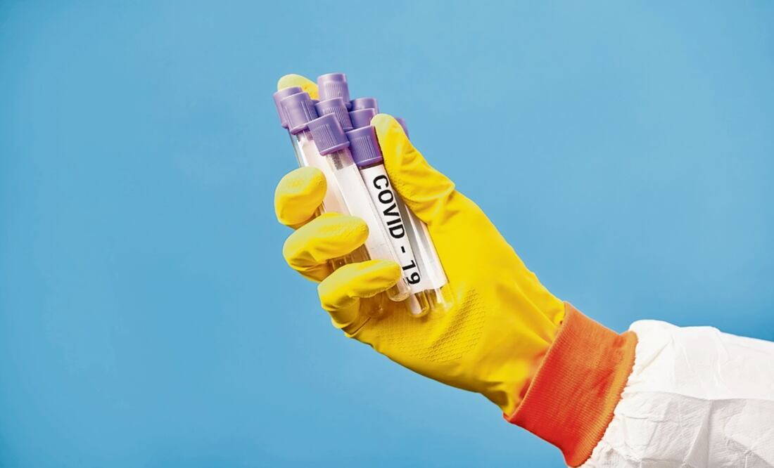 Close-up shot hand of nurse holds medical test tubes for coronavirus – Photo: File photo/EL UNIVERSAL