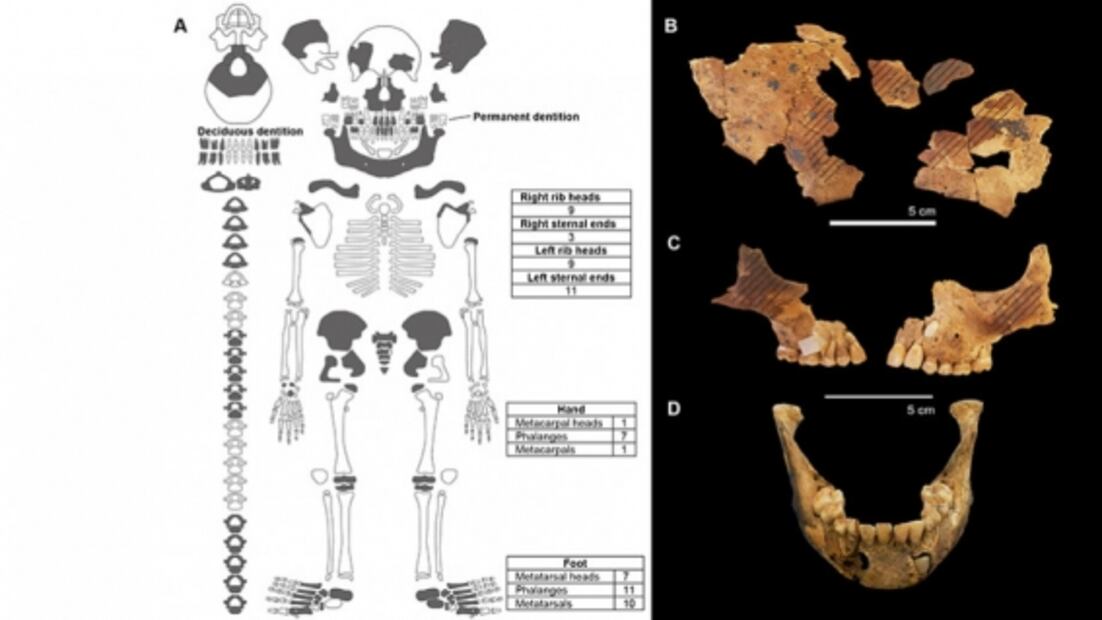 Entierro de niño de hace 8 mil años revela amputación de sus extremidades