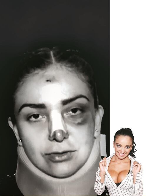 La Wanders Lover (Yared Licona) hizo pública la golpiza que le propinó Radamés de Jesús (ESPECIAL)