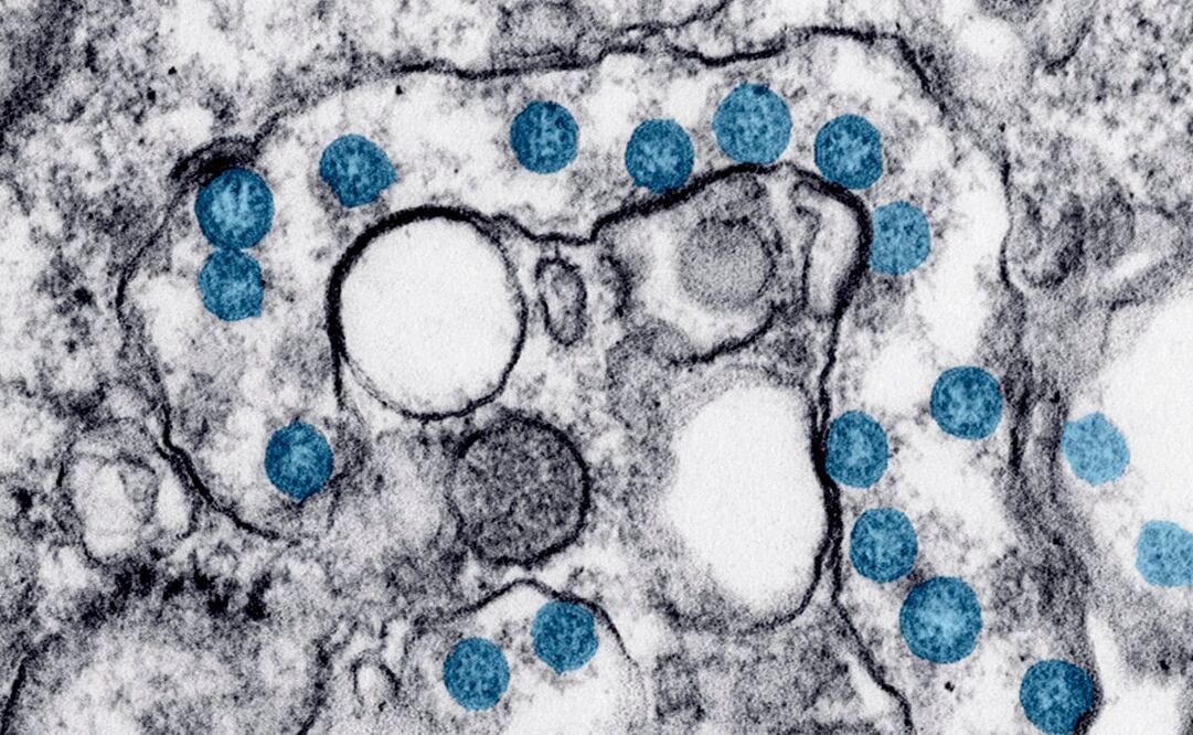 Imagen genérica en las que se muestran partículas del nuevo coronavirus. Foto: Hannah A. Bullock, Azaibi Tamin/CDC via AP, archivo