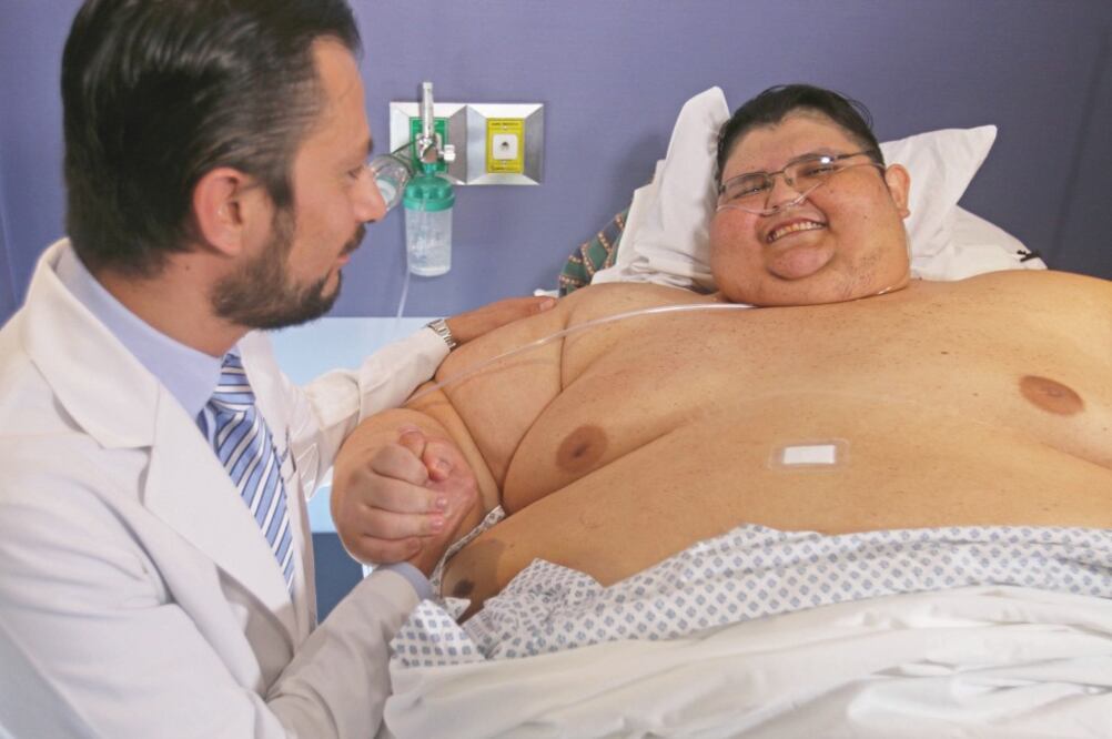 Con esta segunda intervención qurúrgica se espera que en un año y medio, aproximadamente, Juan Pedro pese alrededor de 120 kilos. (ARCHIVO EL UNIVERSAL)