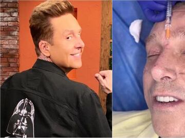 Daniel Bisogno se sometió a rejuvenecimiento facial, este fue el resultado