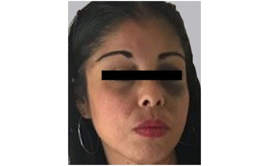 (Fotografía: Especial )