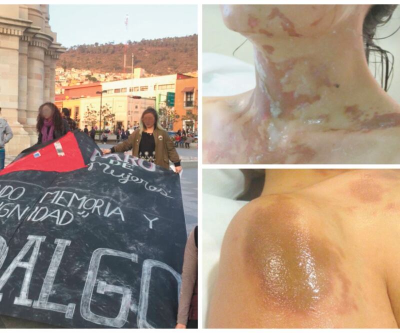 Después de decenas de tratamientos y cirugías, Leslie se está recuperando y sanando las heridas internas; retomó su trabajo y continúa un proceso legal para castigar a sus agresores.