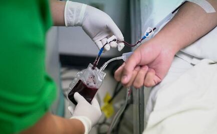 Sangre tipo A aumenta en un 50% las probabilidades de padecer Covid-19 grave