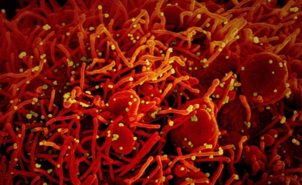 El cambio climático permitió la aparición del Covid-19: estudio