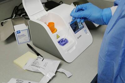  Alertan sobre deficiencias de prueba rápida de Covid-19