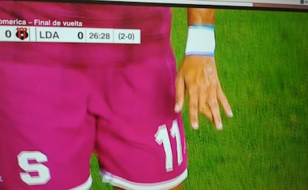 Escalofriante fractura durante la final de la liga de Costa Rica