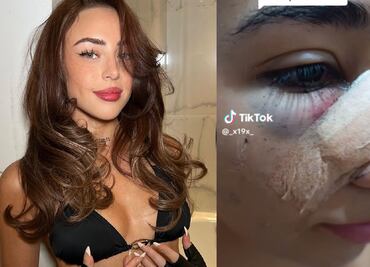 Fan de Nicki Nicole relata cómo terminó en el hospital tras recibir un botellazo de la cantante