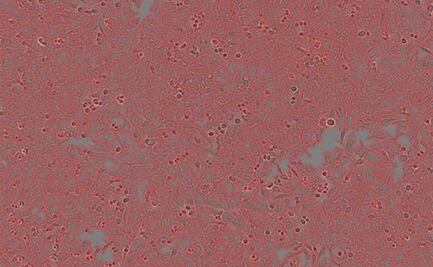 Un "talón de Aquiles" de las células cancerosas es descubierto por investigadores