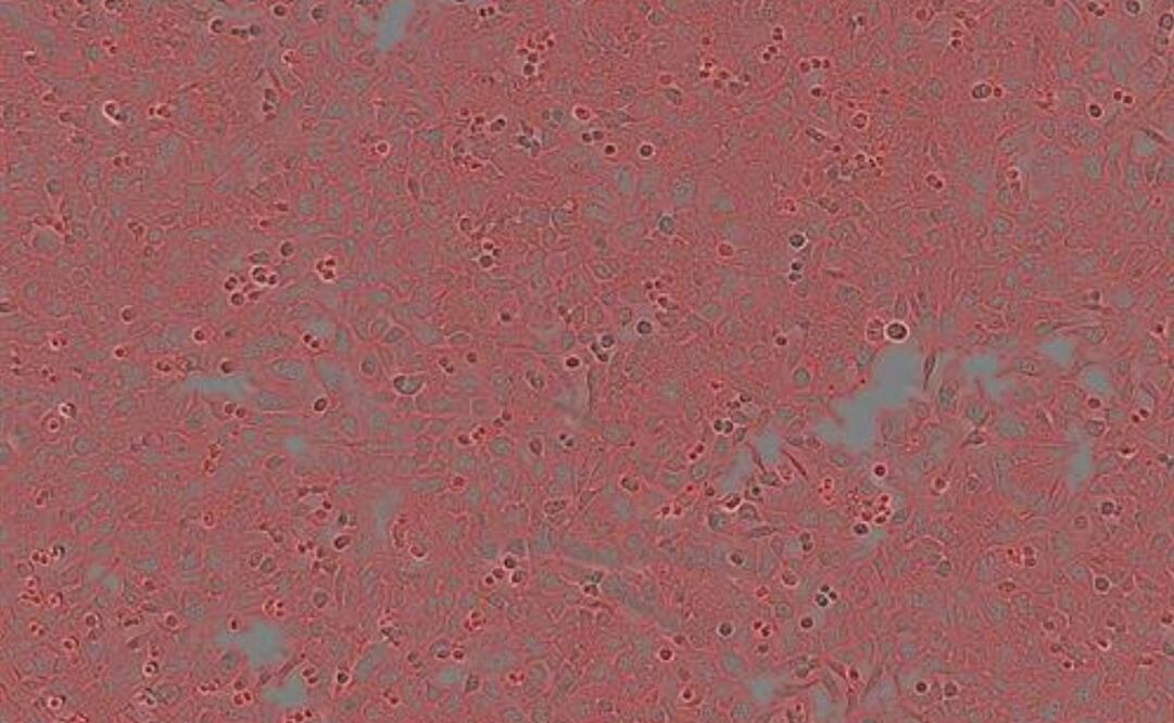 Foto: UNIVERSIDAD DE TEL AVIV vía Europa Press