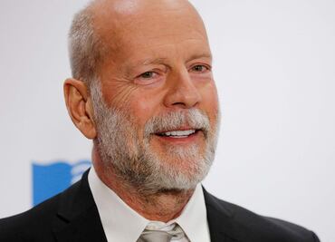 Bruce Willis: ¿Qué es la demencia frontotemporal y que relación tiene con la afasia?