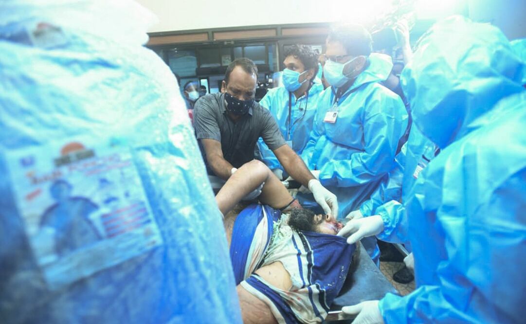 Pasajero es llevado para recibir tratamiento al Medical College Hospital en Kozhikode, en la India. Foto: AP