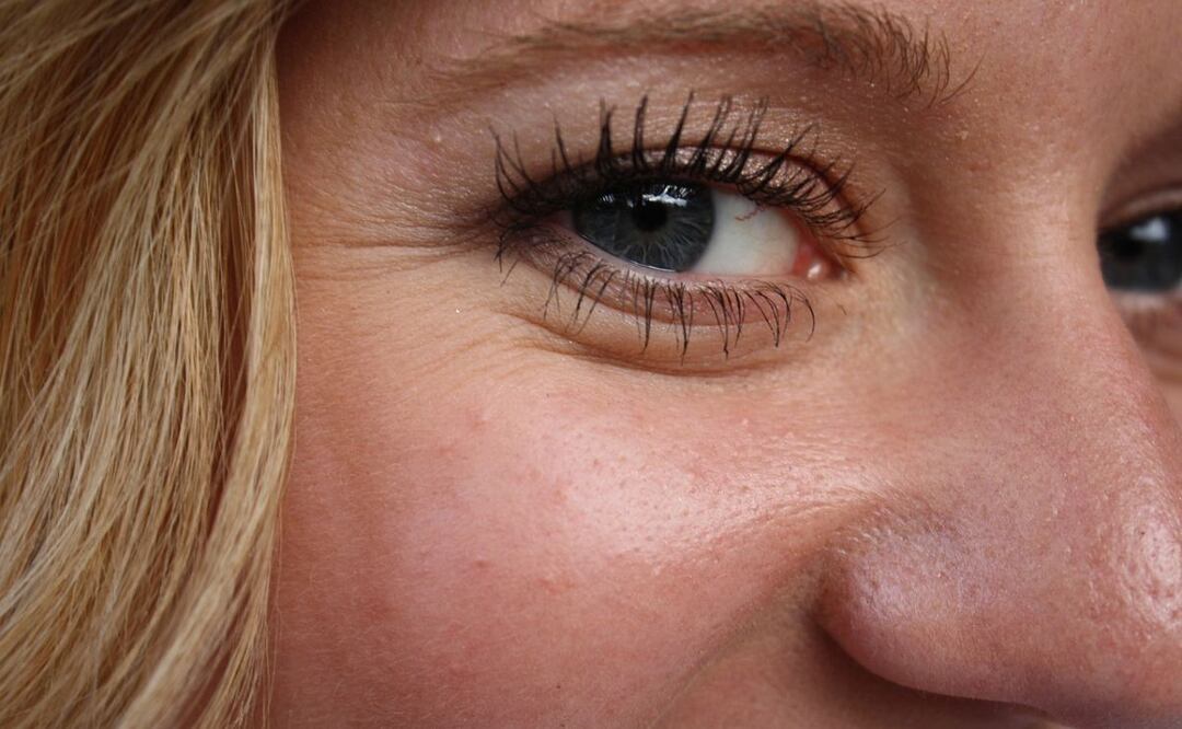 Suero y estética. Fuente: Pixabay