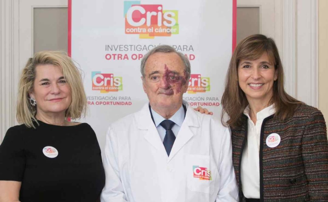 El doctor Mariano Barbacid junto a su equipo de trabajo, quienes lograron eliminar el cáncer de páncreas en ratones / Foto: @criscancer