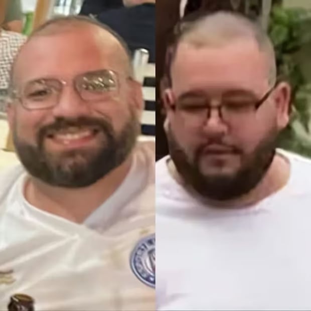 El médico Perseu de Almeida y Taillon de Alcântara Pereira Barbosa
O Globo / GDA